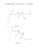 HIGH ACCESS CONSUMABLES FOR A PLASMA ARC CUTTING SYSTEM diagram and image