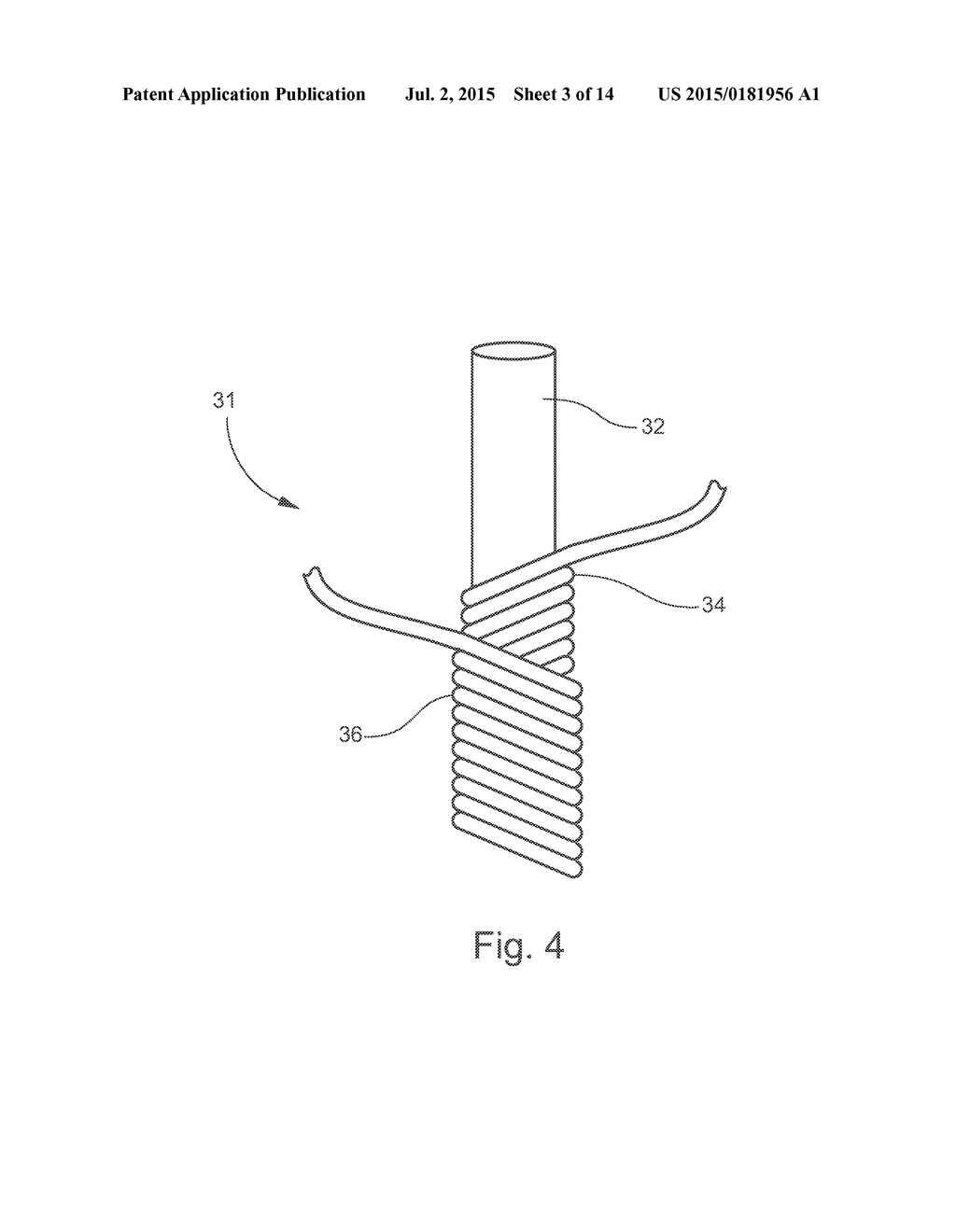 PROTECTIVE GLOVE WITH ENHANCED EXTERIOR SECTIONS - diagram, schematic, and image 04