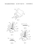 MACHINE FOR MAKING AN IMPERMEABLE JOIN ON IMPERMEABLE THREE-LAYER OR     TWO-LAYER FABRICS diagram and image