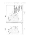 System and Method for Generating A 2D Image from a Tomosynthesis Data Set diagram and image