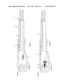 DEVICE AND METHOD FOR CONDUCTING A PAP SMEAR TEST diagram and image