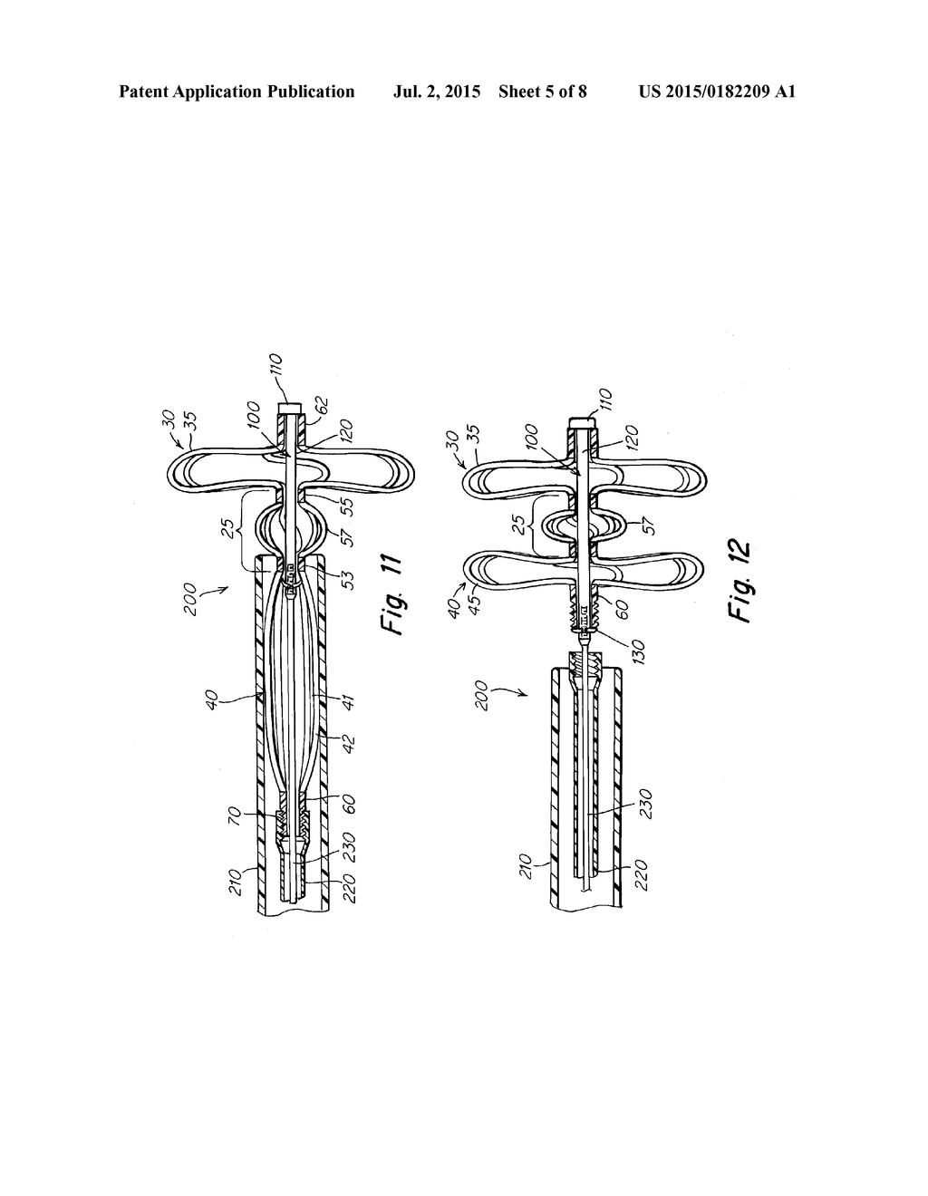 Septal Closure Device with Centering Mechanism - diagram, schematic, and image 06