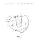 SYSTEMS AND METHODS FOR PREPARING A PROXIMAL TIBIA diagram and image