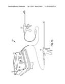 DEVICES AND TECHNIQUES FOR CUTTING AND COAGULATING TISSUE diagram and image