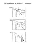Method and Device for Attaching a Bone Plate diagram and image