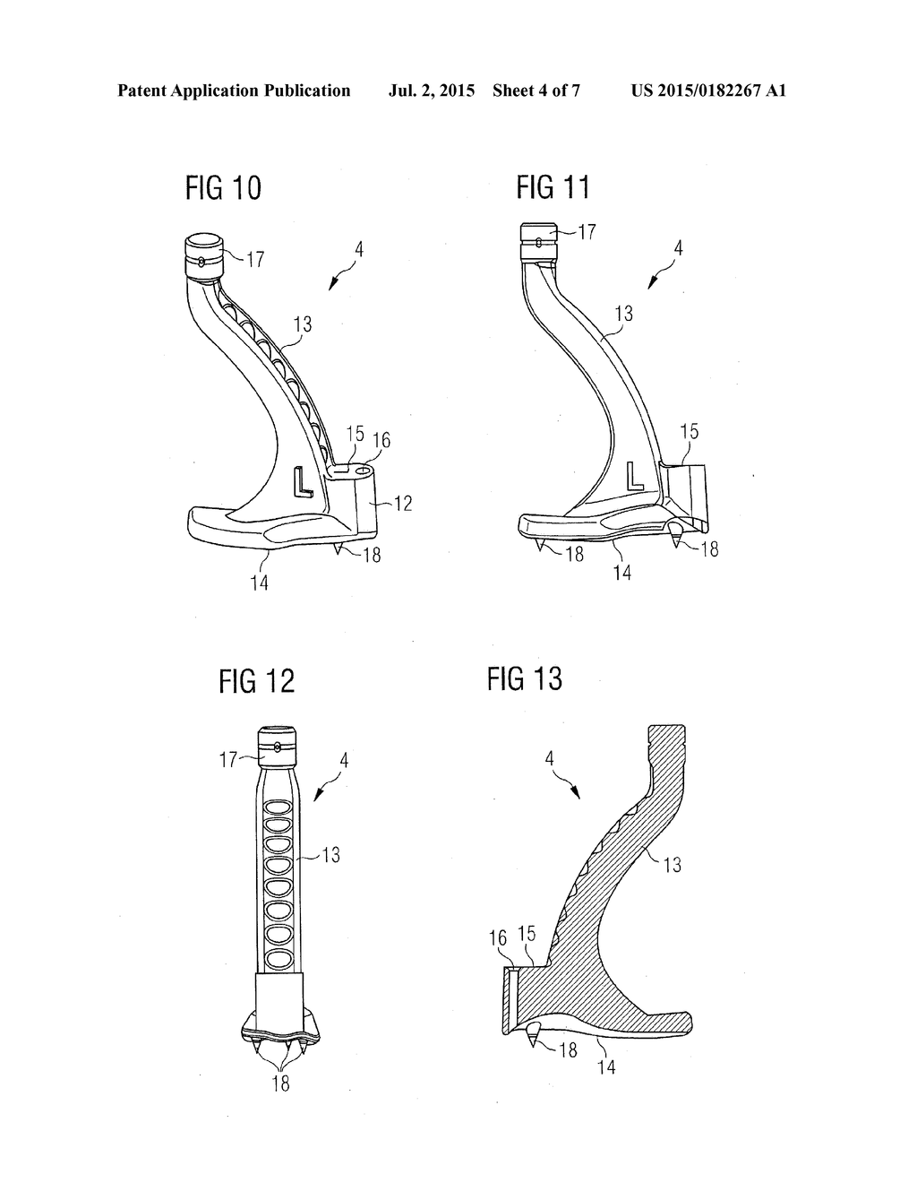 Method and Device for Attaching a Bone Plate - diagram, schematic, and image 05