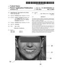 ORTHODONTIC TREATMENT PLANNING USING LIP TRACER diagram and image