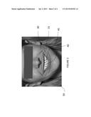 ORTHODONTIC TREATMENT PLANNING USING LIP TRACER diagram and image