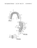 Customized Orthodontic Appliance and Method diagram and image