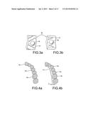 Customized Orthodontic Appliance and Method diagram and image