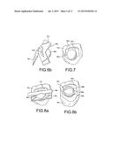 Customized Orthodontic Appliance and Method diagram and image