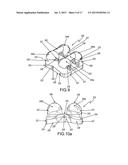 Customized Orthodontic Appliance and Method diagram and image