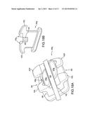 Customized Orthodontic Appliance and Method diagram and image