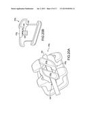 Customized Orthodontic Appliance and Method diagram and image