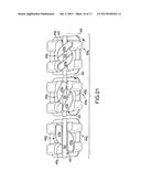 Customized Orthodontic Appliance and Method diagram and image