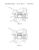 TRANSFER COPINGS AND RELATED METHODS FOR TAKING IMPLANT IMPRESSIONS diagram and image