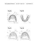 Apparatus and Methods of Making Denture Devices diagram and image