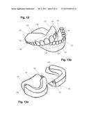 Apparatus and Methods of Making Denture Devices diagram and image