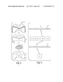 RESTORATION, RESTORATION COMPONENTS, AND METHODS OF MAKING A DENTAL     RESTORATION diagram and image