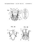 PROSTHETIC HEART VALVE HAVING IDENTIFIERS FOR AIDING IN RADIOGRAPHIC     POSITIONING diagram and image