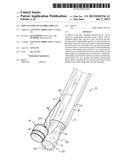 IMPLANTATION OF FLEXIBLE IMPLANT diagram and image