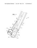 IMPLANTATION OF FLEXIBLE IMPLANT diagram and image