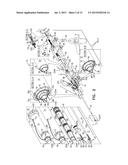 IMPLANTATION OF FLEXIBLE IMPLANT diagram and image