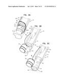 IMPLANTATION OF FLEXIBLE IMPLANT diagram and image