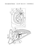 IMPLANTATION OF FLEXIBLE IMPLANT diagram and image