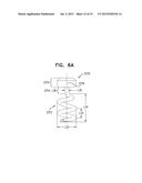 IMPLANTATION OF FLEXIBLE IMPLANT diagram and image