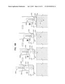 IMPLANTATION OF FLEXIBLE IMPLANT diagram and image