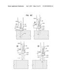 IMPLANTATION OF FLEXIBLE IMPLANT diagram and image