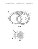 DRUG DELIVERY SYSTEMS AND METHODS FOR TREATMENT OF BLADDER DYSFUNCTION OR     DISORDER USING TROSPIUM diagram and image