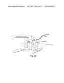 TREATMENT OF MUSCULAR DYSTROPHIES AND RELATED DISORDERS diagram and image