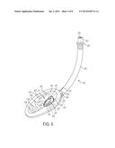 Self-Pressurizing Supraglottic Airway diagram and image