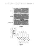 USE OF PEDF-DERIVED POLYPEPTIDES FOR PROMOTING STEM CELLS PROLIFERATION     AND WOUND HEALING diagram and image