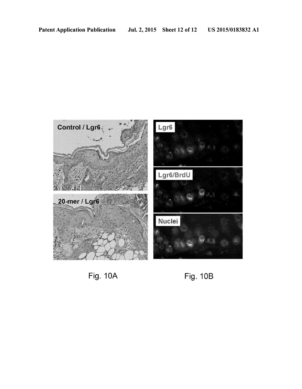 USE OF PEDF-DERIVED POLYPEPTIDES FOR PROMOTING STEM CELLS PROLIFERATION     AND WOUND HEALING - diagram, schematic, and image 13