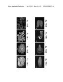 SOYBEAN ADF1 PROMOTER AND ITS USE IN CONSTITUTIVE EXPRESSION OF TRANSGENIC     GENES IN PLANTS diagram and image