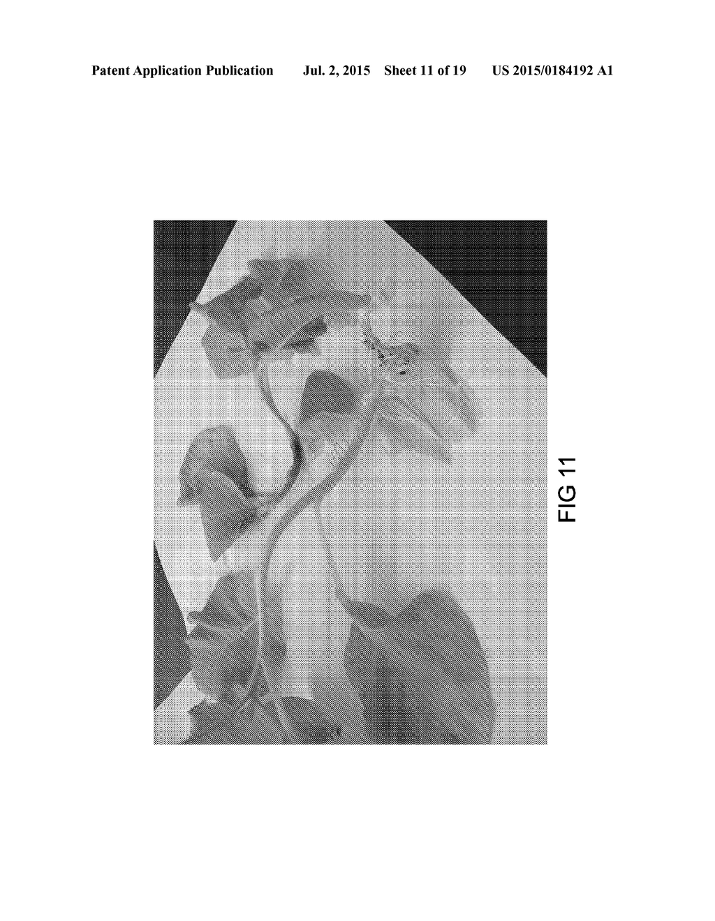 FUNGAL RESISTANCE IN SOYBEANS BY GENE SILENCING - diagram, schematic, and image 12