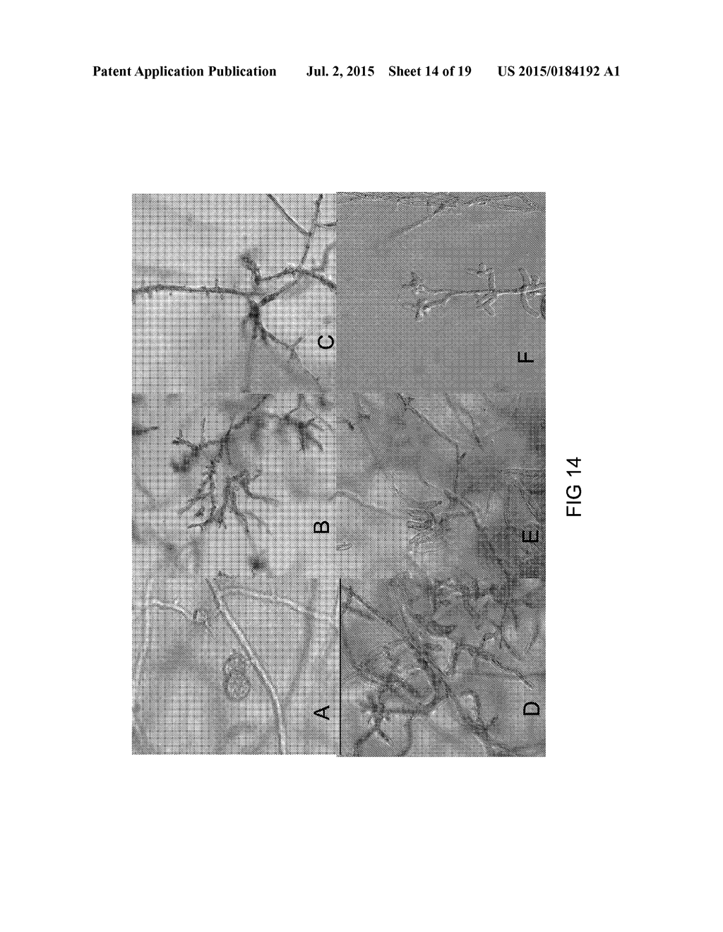 FUNGAL RESISTANCE IN SOYBEANS BY GENE SILENCING - diagram, schematic, and image 15