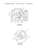 METHODS OF FORMING AND REPAIRING DOWNHOLE TOOLS HAVING FEATURES FOR     REDUCING BALLING diagram and image