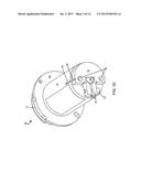 INJECTION-COMPRESSION MOLDED ROTORS diagram and image