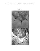 FORMULAIC IMAGING FOR TISSUE DIAGNOSIS diagram and image