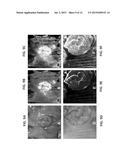 FORMULAIC IMAGING FOR TISSUE DIAGNOSIS diagram and image