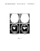 Method and Apparatus for Reconstruction of Magnetic Resonance Imaging diagram and image