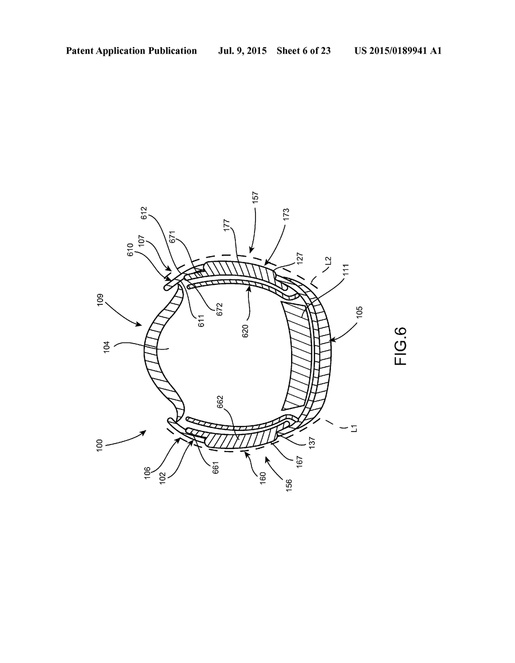 Article of Footwear With a Customizable Upper - diagram, schematic, and image 07