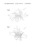 MEDICAL IMAGING APPARATUS TO DETECT A MOVING PART OF A PATIENT S BODY diagram and image