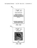 APPARATUS AND METHOD FOR FETAL INTELLIGENT NAVIGATION ECHOCARDIOGRAPHY diagram and image