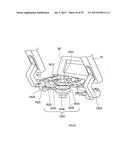 PORTABLE ULTRASOUND IMAGING APPARATUS diagram and image