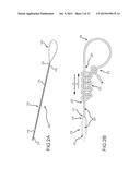 LEFT ATRIAL APPENDAGE TREATMENT SYSTEMS AND METHODS diagram and image